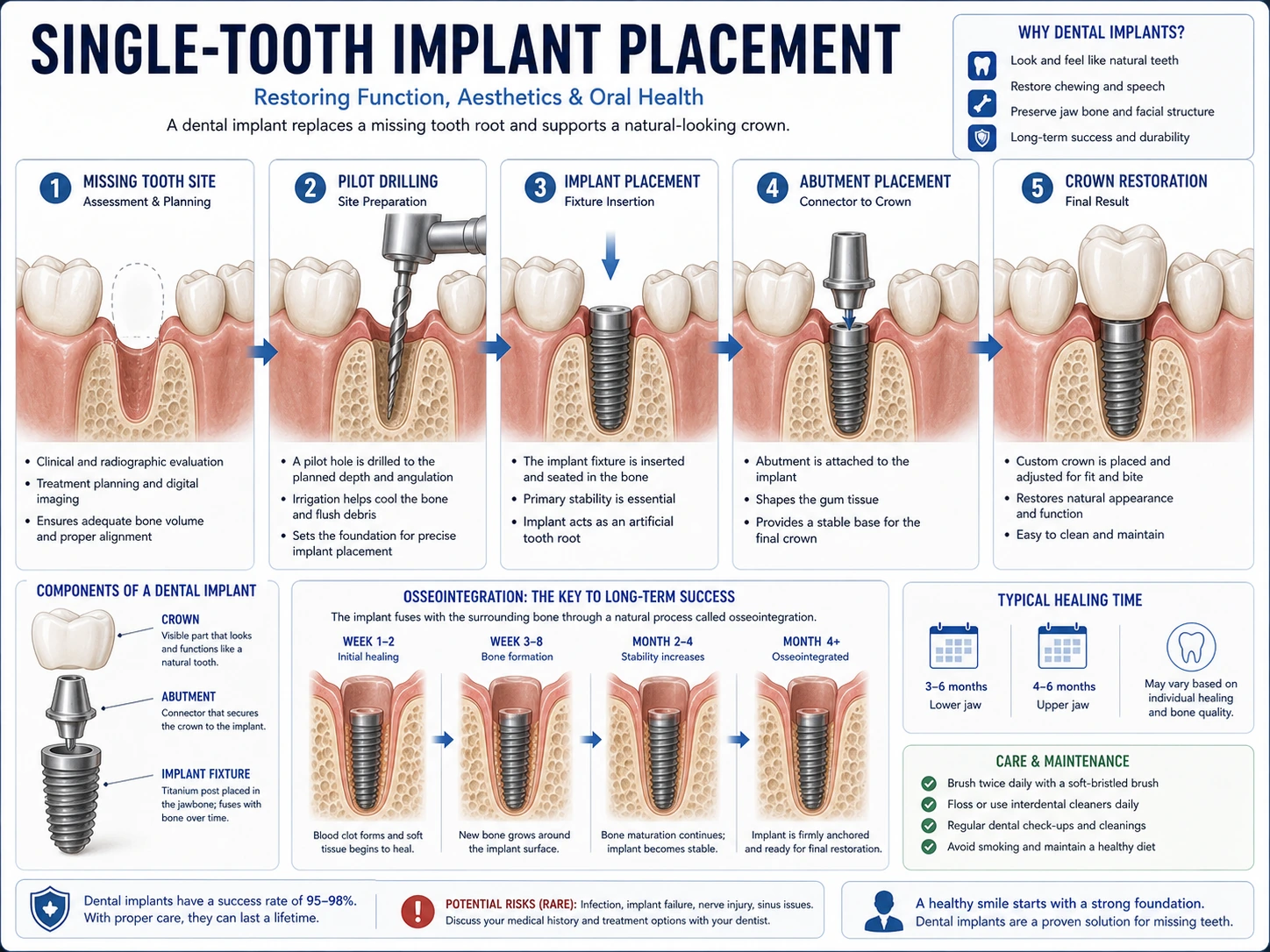 Occlusion dental draft