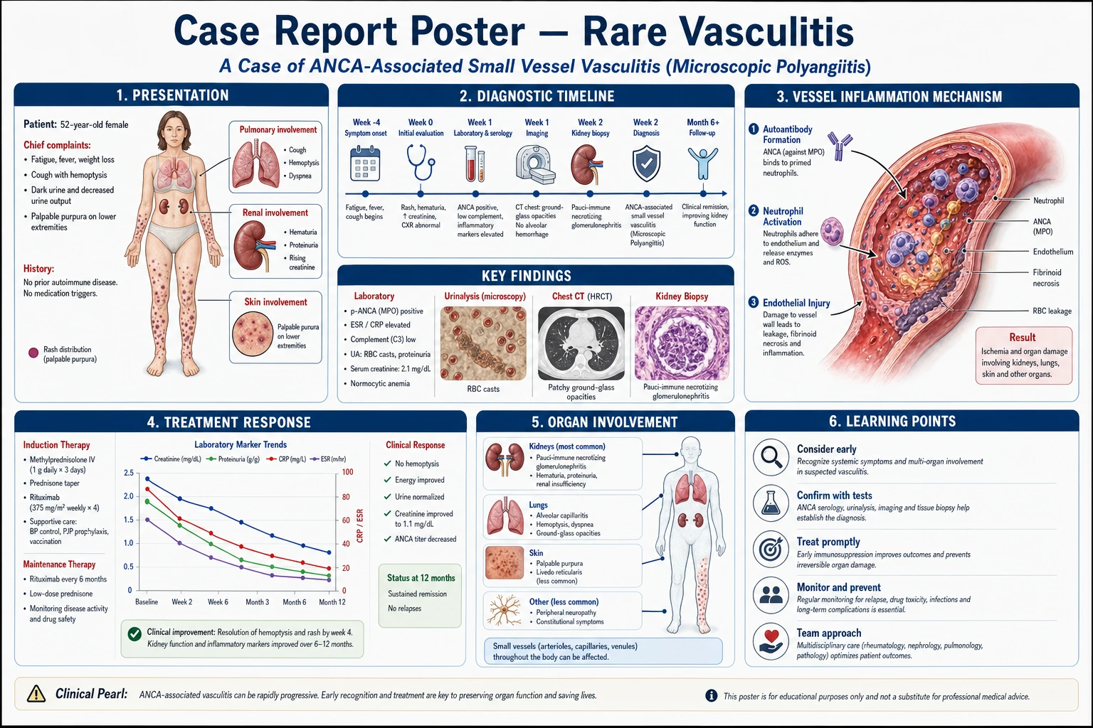 Case report medical poster with patient timeline, CT imaging panel, pathology summary, intervention steps, and discussion points