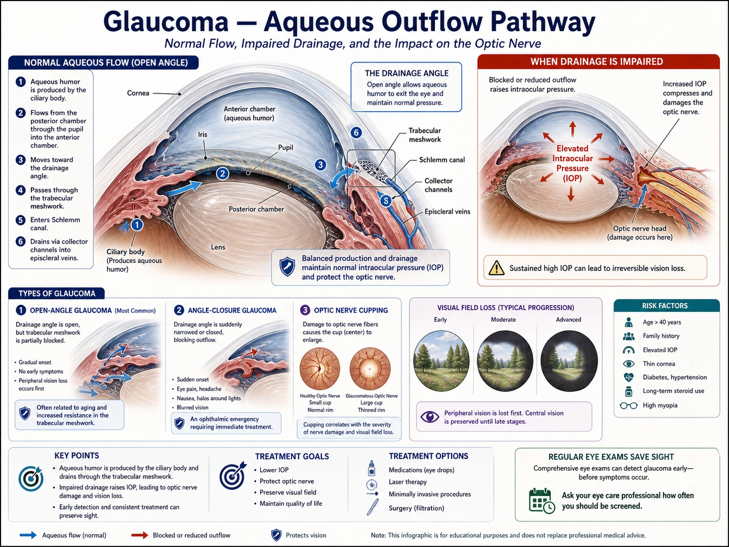 Aqueous humor flow ophthalmology draft